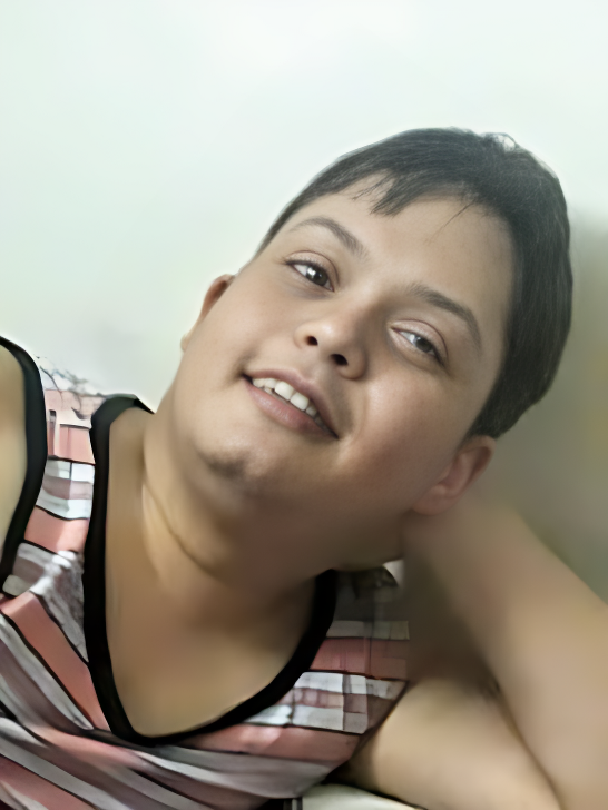 Down Syndrome